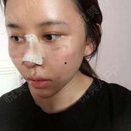 吃瓜抠鼻子教程,吃瓜抠鼻子两不误的实用教程