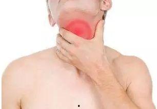 吃白瓜喉咙痒,揭秘原因及应对策略